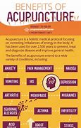 Image result for Benefits of Acupuncture