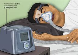 Image result for Philips CPAP Machine