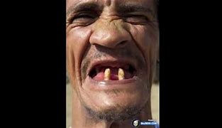Image result for Funny Ugly Pictures with Theeth Out