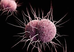 Image result for Gonorrhea in the Throat
