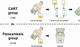 Image result for Paracentesis Vacuum Bottles