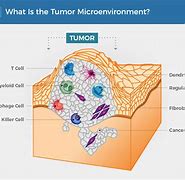Image result for What Is Solid Tumor Cancer