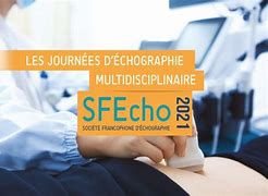 Image result for sfecho