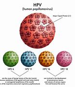 Image result for Minor Genital Human Papillomavirus