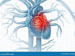 Image result for cardiopathy
