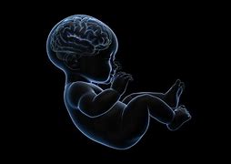 Image result for Brain Problem Baby Born With