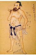 Image result for Chinese Acupuncture Art