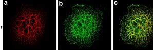 Image result for actin�grafi