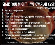 Image result for ovarian cyst symptoms