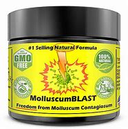 Image result for Molluscum Contagiosum Cream