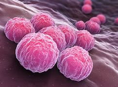 Image result for Chlamydia Trachomatis Discharge Color