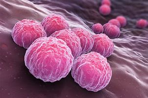 Image result for Chlamydia Bacterial Infection
