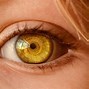 Image result for LASIK Eye