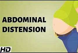 Image result for Abdominal Distension