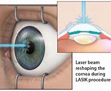 Image result for Robot Laser Beam Eye