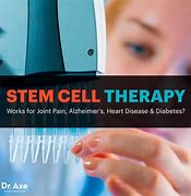 Image result for Stem Cell Therapy