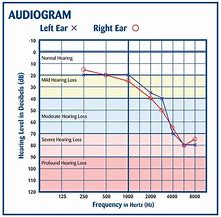 Image result for Heairng Aid Test Chart