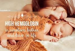 Image result for Fetal Hemoglobin