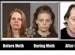 Image result for Funny Before and After Meth