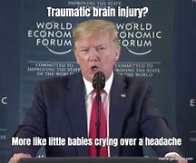 Image result for Brain Damage Meme Face