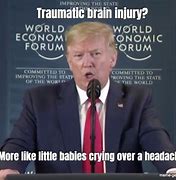 Image result for Broken Brain Meme