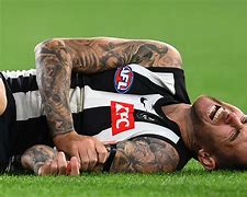 Image result for Jeremy Howe Broken Arm