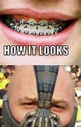 Image result for Pinoy Braces Memes
