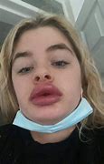 Image result for People with Fish Lips