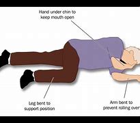 Image result for Epilepsy Recovery Position