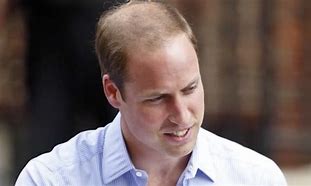 Image result for Prince William Hairline