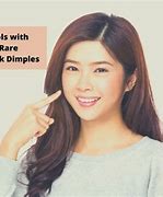 Image result for Upper Cheek Dimples