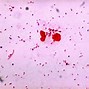 Image result for Gonorrhea Gram Stain