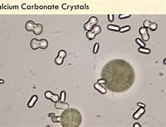 Image result for Calcium Carbonate Crystals