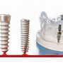 Image result for Affordable Denture Implants