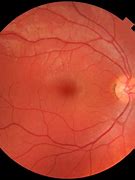 Image result for Eye Retina Image