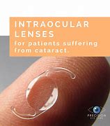 Image result for Sulcus Intraocular Lens