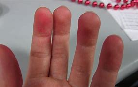 Image result for Wicketkeeper Fingers
