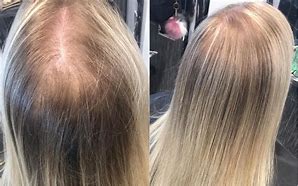 Image result for Hairstyles to Cover Thinning Hair