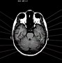Image result for _Brain Anatomy