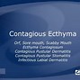 Image result for Ecthyma Contagiosum