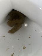 Image result for Grainy Poop