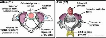 Image result for Atlas vs Axis Vertebrae