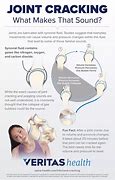 Image result for Neck Joint Cracking