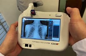 Image result for Digital X-ray Sensor