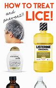Image result for Home Remedies for Lice and Nits