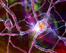 Image result for Alzheimer Neuron
