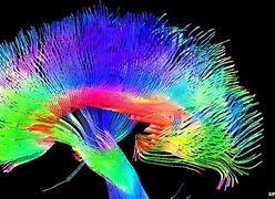 Image result for Artistic Brain