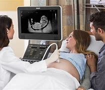 Image result for Philips Ultrasound Transducers
