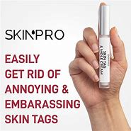 Image result for Skin Tag Removers That Work