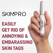 Image result for Skin Pro Skin Tag and Mole Remover